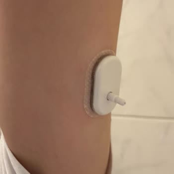 Sibionics Türkiye Cgm Cihazlarında Yaşanan Ciddi Sorunlar Ve Müşteri Hizmetleri Mağduriyeti