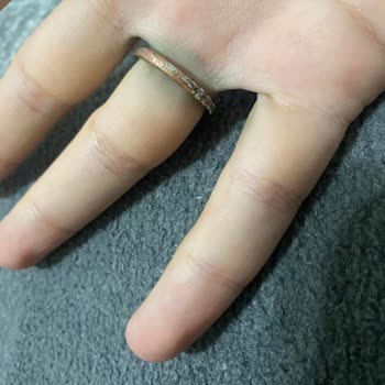 Swarovski Yüzükte Erken Renk Değişimi Ve Deformasyon