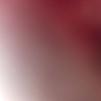 Kırılan Süpürge Parçası İçin Garanti Dışı Bırakılan Ve Geciken Servis Süreci Mağduriyeti