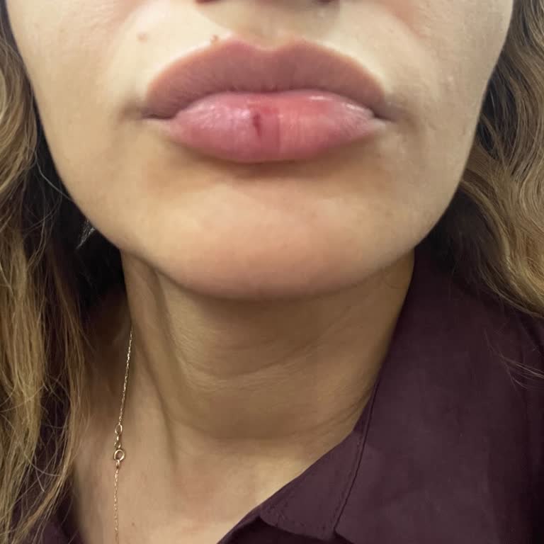 Stajyer Doktorun Hatasıyla Kimyasal Yanık Ve İlgisizlik Mağduriyeti