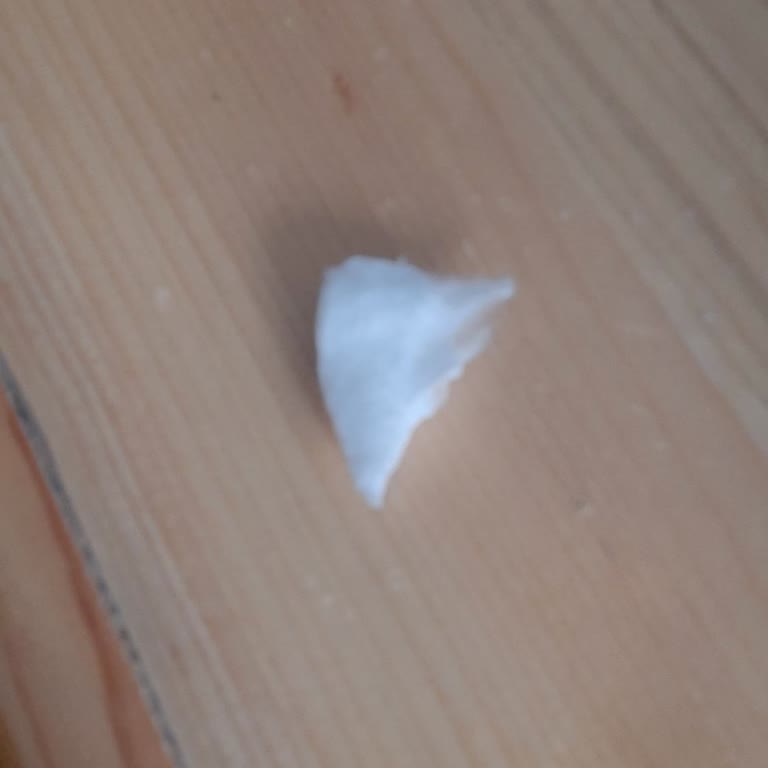 Bebek Bezinde Sert Cisim Çıktı, Bebeğimde Kızarıklık Ve Huzursuzluk Oluştu