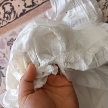 Molfix Bebek Bezinde Üretim Hatası Ve Müşteri Hizmetlerinden Yanıt Alamadım