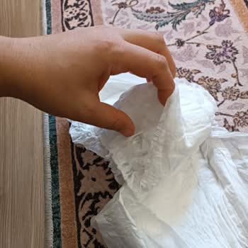 Molfix Bebek Bezinde Üretim Hatası Ve Müşteri Hizmetlerinden Yanıt Alamadım