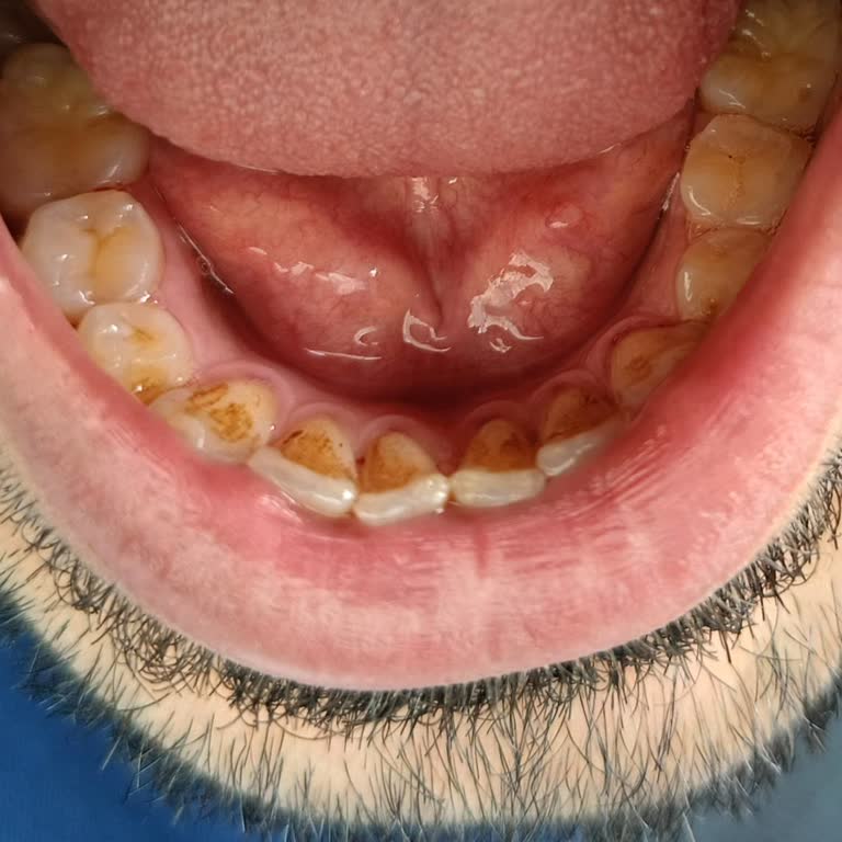 Özel Pırlanta Ağız ve Diş Sağlığı Polikliniği Dişlerimde Hiçbir Temizlik Yapılmadı