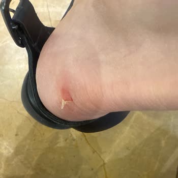 Guess Ayakkabı Kısa Sürede Ciddi Yara Ve Mağaza Değişim Reddiyle Hayal Kırıklığı