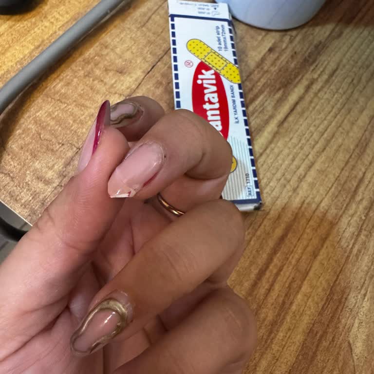 Gökçe Karadeniz Nail Art Studio Hem Tırnaklarım Mahvoldu Hem Çok Acı Çektim!