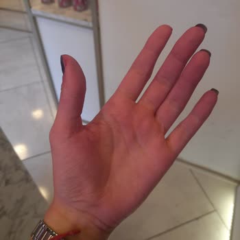 Saç Boyası Hem Renklendirmedi Hem De Cildimde Kalıcı Leke Bıraktı