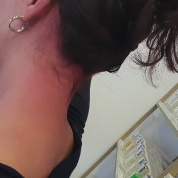 Saç Boyası Hem Renklendirmedi Hem De Cildimde Kalıcı Leke Bıraktı