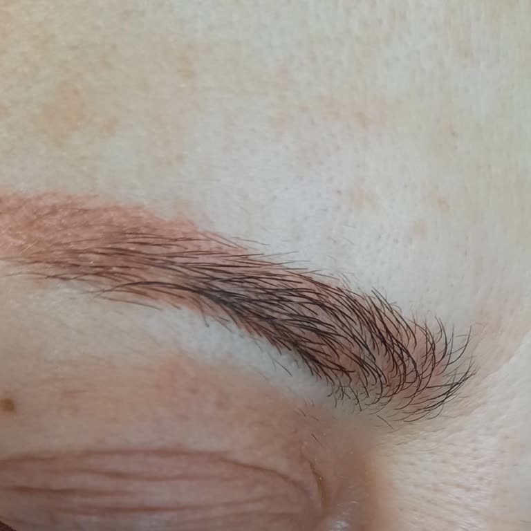 Novar Poliklinik Novar Güzellik Merkezi Şikayeti