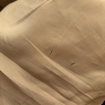 Sarprive Gömleğin Kumaşı 3 Giyişte Eriyerek Yırtıldı