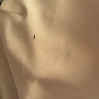 Sarprive Gömleğin Kumaşı 3 Giyişte Eriyerek Yırtıldı