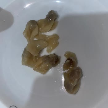 Son Kullanma Tarihi Geçmemiş Superfresh Mantı Bozuk Çıktı