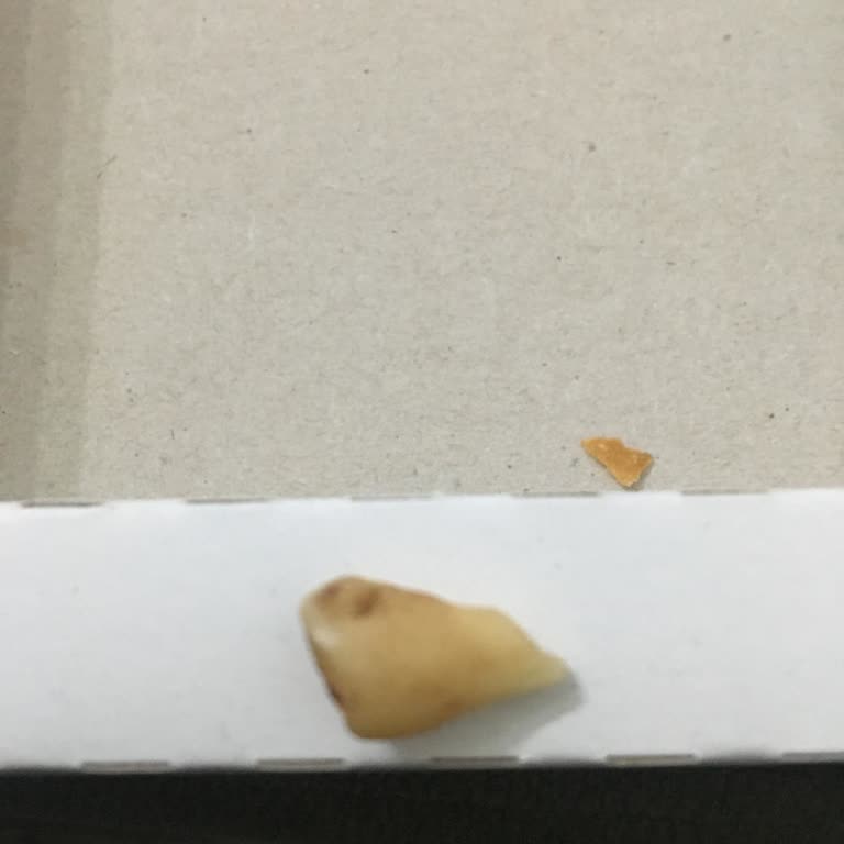 Saraylıoğlu Şekerleme Pişmaniyeden Yabancı Madde Çıktı