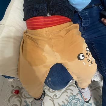 Molfix 6 Numara Bebek Bezlerinde Sürekli Sızdırma Problemi