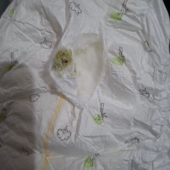 Bebek Bezinde Küf Ve Sağlık Riski Şikayeti