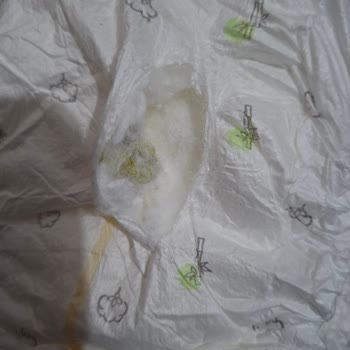 Bebek Bezinde Küf Ve Sağlık Riski Şikayeti