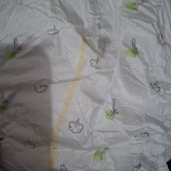 Bebek Bezinde Küf Ve Sağlık Riski Şikayeti