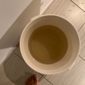 Garanti Sonrası Sürekli Arıza Yapan Kombi Ve Yetersiz Servis Desteği