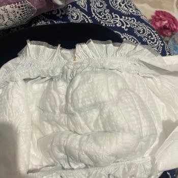 Molfix 5 Numara Bebek Bezinde Sızdırma Ve Üretim Hatası Şoku