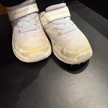 Kısa Sürede Deforme Olan Çocuk Ayakkabısı Ve Yetersiz Garanti Süreci