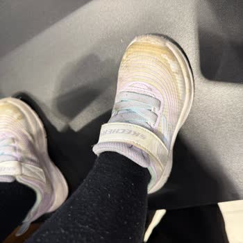 Kısa Sürede Deforme Olan Çocuk Ayakkabısı Ve Yetersiz Garanti Süreci