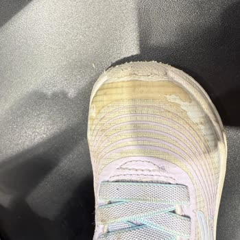 Kısa Sürede Deforme Olan Çocuk Ayakkabısı Ve Yetersiz Garanti Süreci