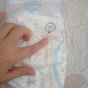 Molfix 6 Beden Bebek Bezinde Kalite Ve Sızdırma Sorunu Yaşadık