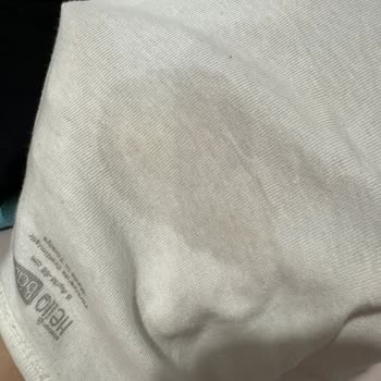 Prima Bebek Bezinde Sürekli Sızdırma Ve Kuruluk Sorunuyla Karşılaşıyorum