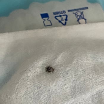 Bebek Islak Mendilinde Böcek Şoku: Acil Açıklama Ve İade Talebi