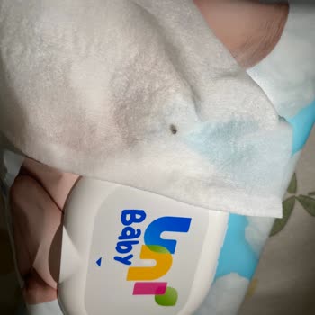 Bebek Islak Mendilinde Böcek Şoku: Acil Açıklama Ve İade Talebi