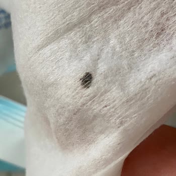 Bebek Islak Mendilinde Böcek Şoku: Acil Açıklama Ve İade Talebi