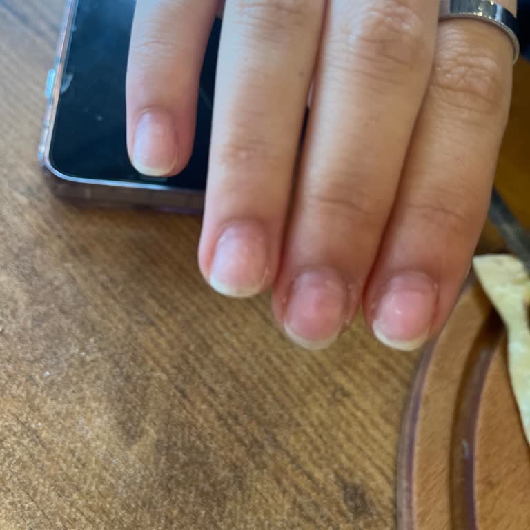 Geç Kalma Nedeniyle Eksik Ve Kötü Hizmet, Saygısız Davranış Ve Çözüm Sunulmaması