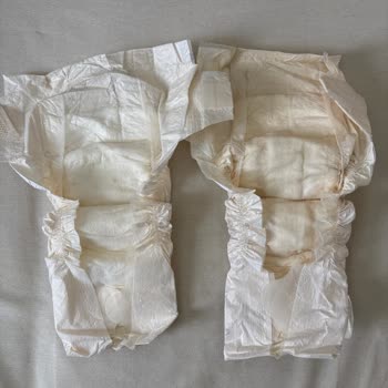 Aldığım Sleepy Bebek Bezlerinde Kalite Sorunu Ve Endişe