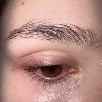 By Hatun's Güzellik Merkezi Kirpik Lifting İşlemi Sonrası Yaşadığım Ciddi Sorunlar Ve Mağduriyet