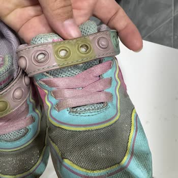 Skechers Çocuk Ayakkabılarında Kısa Sürede Deformasyon Ve Yıpranma