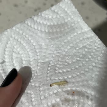 Banetti Noodle Ürününde Kurt Çıkması Ve Yetersiz İletişim