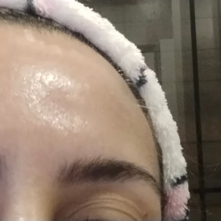 Botoks Sonrası Sağlık Sorunlarıma Çözüm Sunulmadı, Ücret İadesi İstiyorum