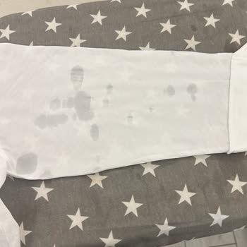 Philips Kazanlı Ütü Sürekli Su Akıtıyor, Servis Yönlendirilmedi