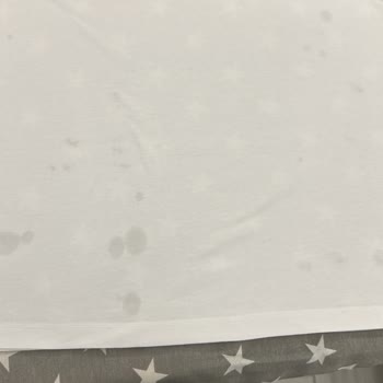 Philips Kazanlı Ütü Sürekli Su Akıtıyor, Servis Yönlendirilmedi