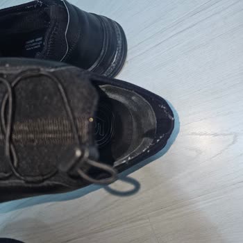 Aldığım Ayakkabı Ciddi Şekilde Ayağımı Yaraladı, Mağaza Çözüm Sunmadı