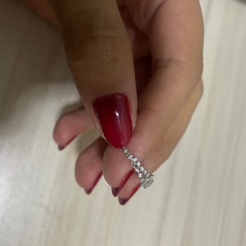 Atasay Yüzüğümde Tekrarlayan Taş Düşmesi Ve Kalıcı Çözüm Talebi