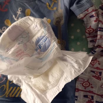 Molfix Çocuk Bezinde Sürekli Tekrarlayan Sızıntı Sorunu