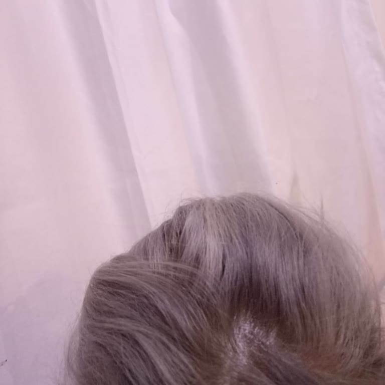 Loreal Saç Boyası Beklenmedik Renk Sonucu Mağduriyeti