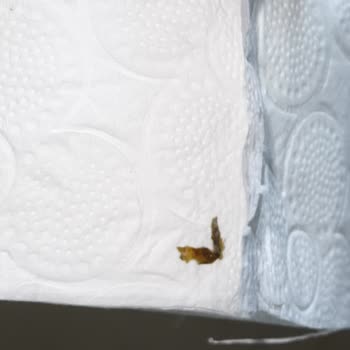 Satın Alınan Tuvalet Kağıdında Hijyen Sorunu Ve Güven Kaybı