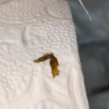 Satın Alınan Tuvalet Kağıdında Hijyen Sorunu Ve Güven Kaybı