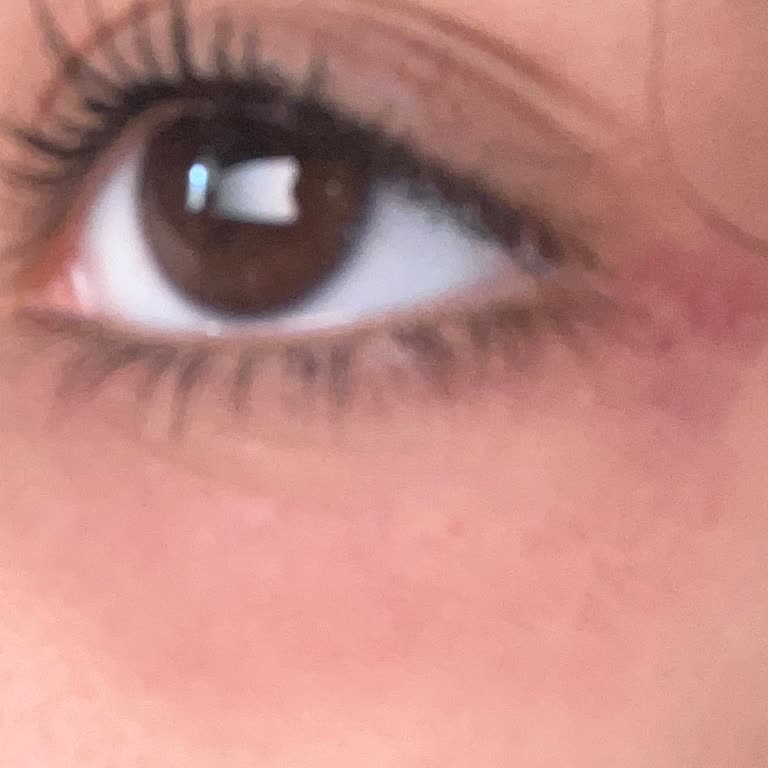 Neutrogena Face Wash Caused Skin Dryness and Under-Eye Irritation