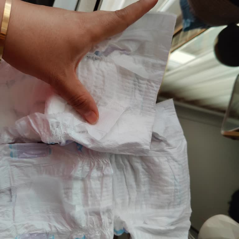 Molfix Bebek Bezinde Tekrarlayan Üretim Hatası Ve Eksik Ürün Teslimatı