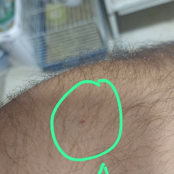 Kan Alma Sırasında Hemşirelerin İlgisiz Ve Saygısız Tavırları Mağduriyet Yaşattı