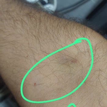 Kan Alma Sırasında Hemşirelerin İlgisiz Ve Saygısız Tavırları Mağduriyet Yaşattı