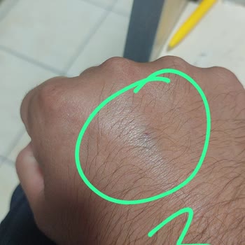 Kan Alma Sırasında Hemşirelerin İlgisiz Ve Saygısız Tavırları Mağduriyet Yaşattı